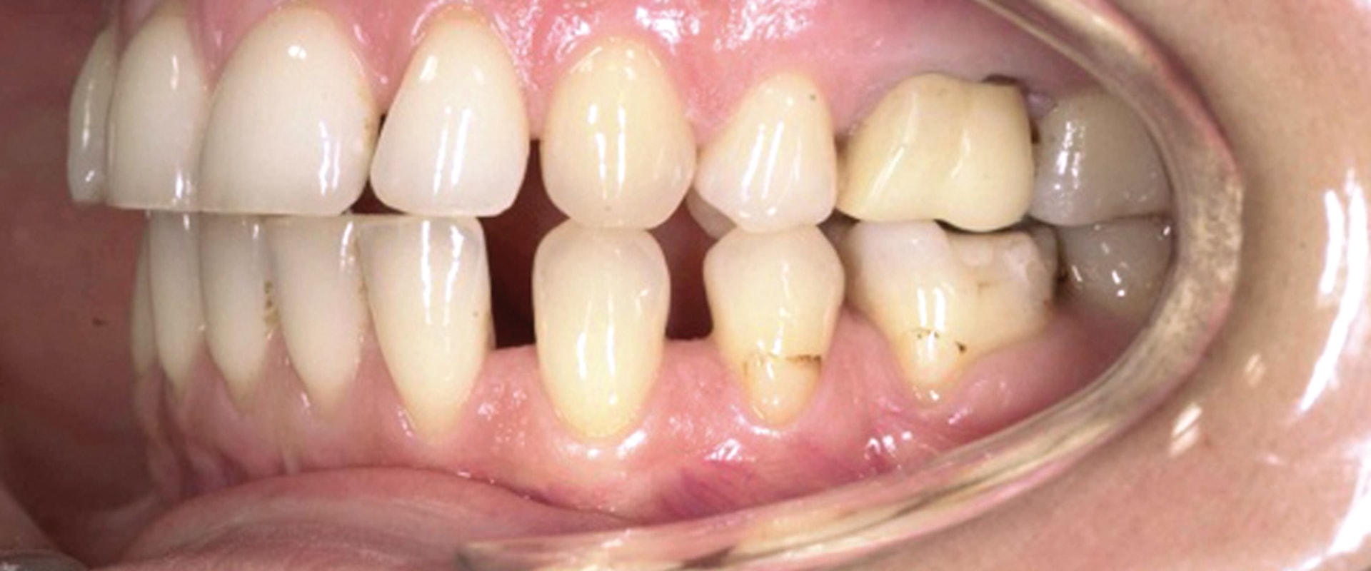 Danni da trattamenti dentali: quando il dentista può essere ritenuto responsabile