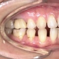 Danni da trattamenti dentali: quando il dentista può essere ritenuto responsabile